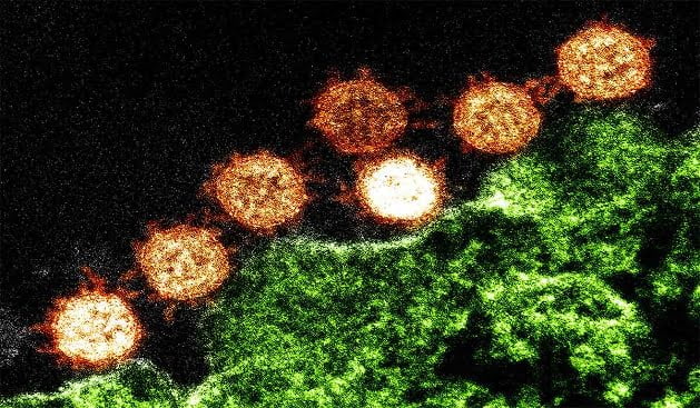 Coronavírus: OMS lança guia para esclarecer dúvidas